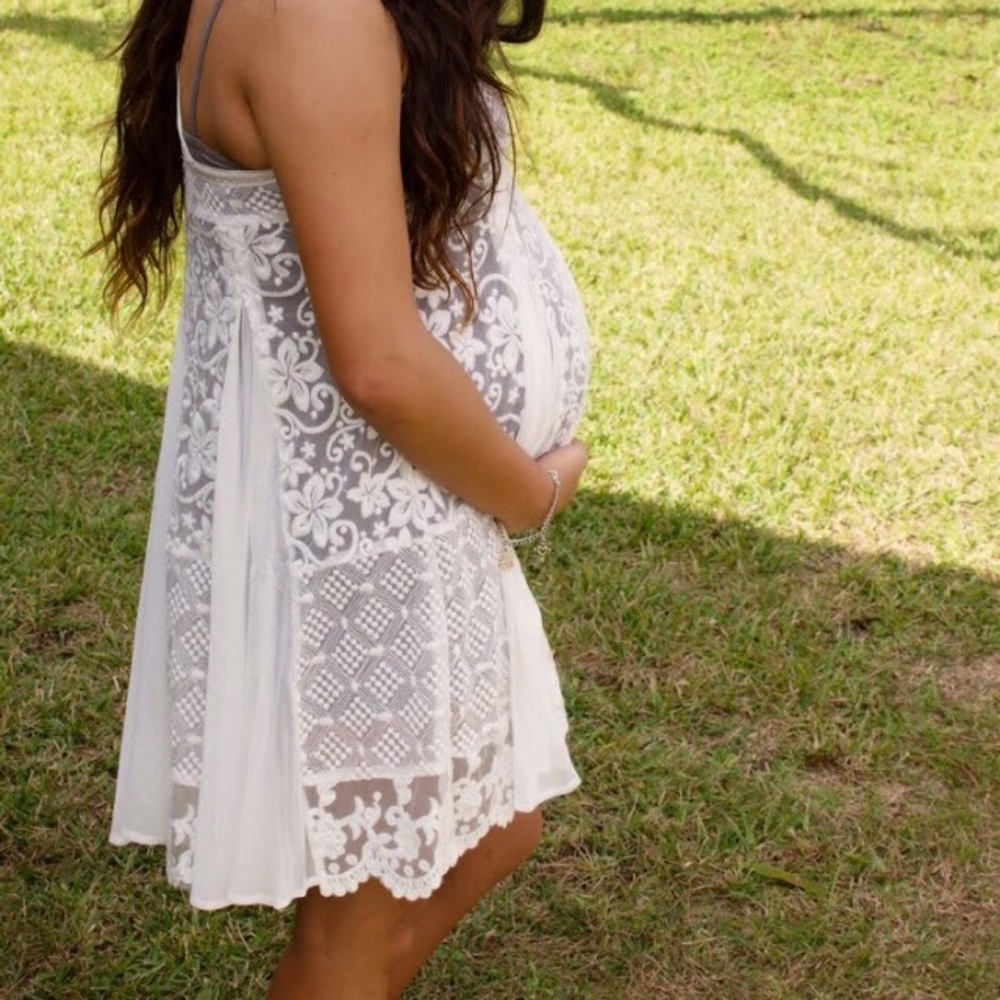 White lace dress